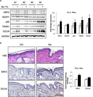 Topical Bixin Confers NRF2-Dependent Protection Against Photodamage and Hair Graying in Mouse Skin